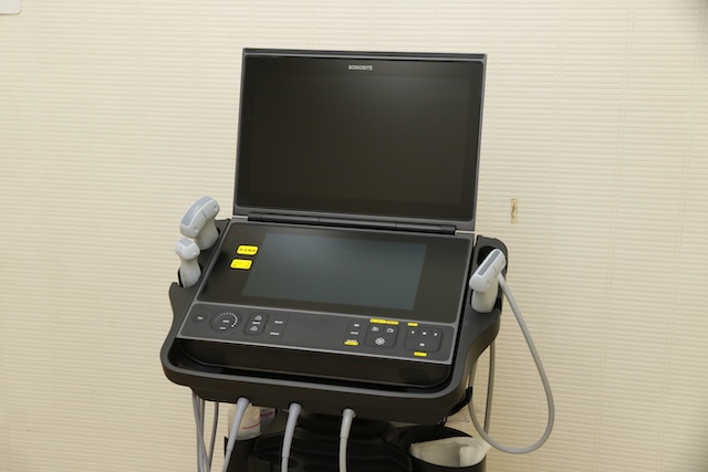 超音波画像診断装置
